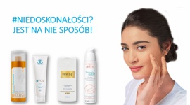 #NIEDOSKONAŁOŚCI? JEST NA NIE SPOSÓB!