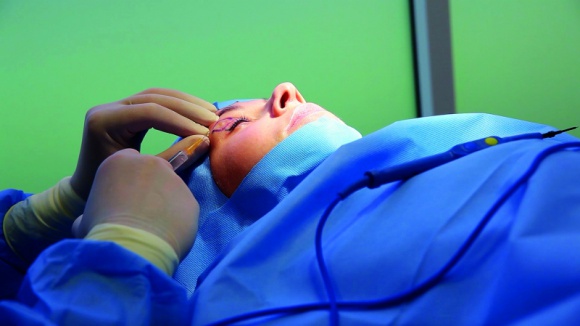 Jak odmłodzić wygląd skóry wokół oczu? Uroda, LIFESTYLE - Problem opadających powiek górnych oraz nadmiaru skóry zgromadzonej w powiekach dolnych nie są wyłącznie oznaką starzenia, ale stanowią także problem natury genetycznej. title =