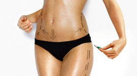 Najskuteczniejsze sposoby na pozbycie się tkanki tłuszczowej Uroda, LIFESTYLE - Sprawdzone sposoby na pozbycie się tkanki tłuszczowej za pomocą różnorodnych zabiegów