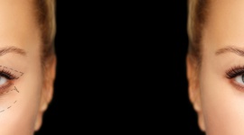 W trosce o młodość spojrzenia Uroda, LIFESTYLE - Oczy to zwierciadło duszy.To właśnie one mówią najwięcej o naszym samopoczuciu i wyrażają emocje. Niestety również jako pierwsze zdradzają nasz wiek, szczególnie kiedy skóra powiek traci sprężystość i zaczyna opadać, a wokół oczu pojawiają się bruzdy i zasinienia.