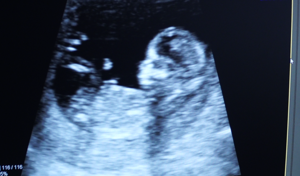 Kobiety w ciąży bardziej narażone na zachorowania w sezonie grypowym. Każda infekcja może okazać się groźna [DEPESZA]