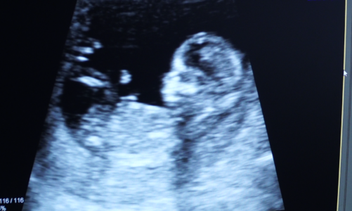 Kobiety w ciąży bardziej narażone na zachorowania w sezonie grypowym. Każda infekcja może okazać się groźna [DEPESZA]